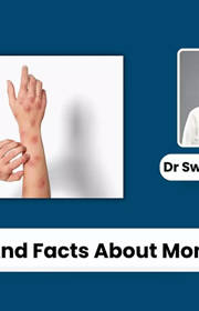 Debunking Common Myths About Monkeypox: Facts You Need to Know - Dr Swati Rajagopal Debunking Common Myths About Monkeypox: Facts You Need to Know - Dr Swati Rajagopal